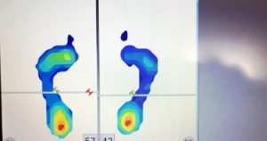 足圧画像-浮き指