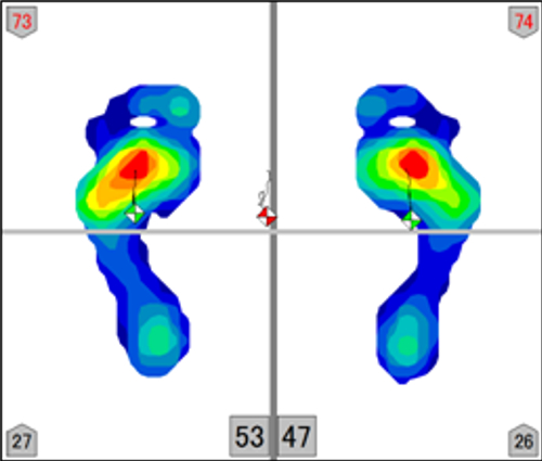 足圧測定画像その1