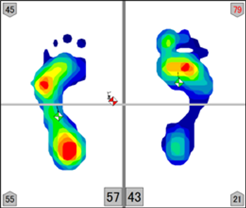 足圧測定画像その4