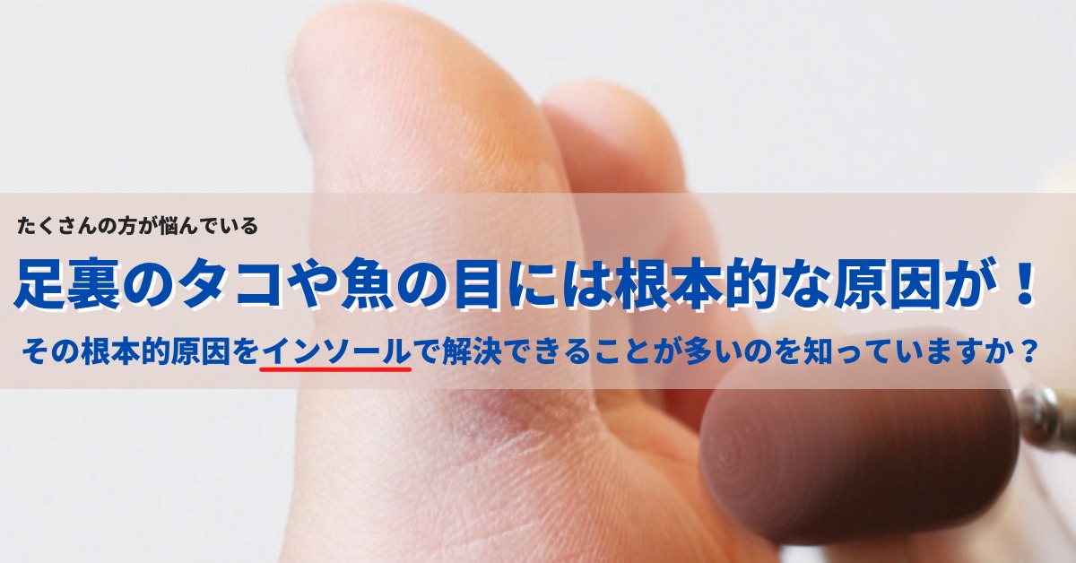 足裏のタコや魚の目には根本的な原因が！ファイン・プロデュース オンラインショップページへ